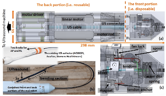 Figure 1 for Design and validation of zero-slack separable manipulator for Intracardiac Echocardiography