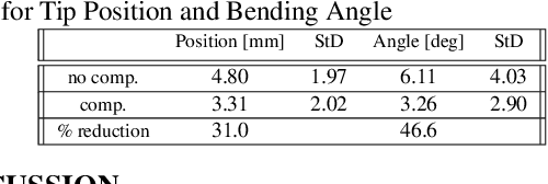 Figure 2 for Design and validation of zero-slack separable manipulator for Intracardiac Echocardiography