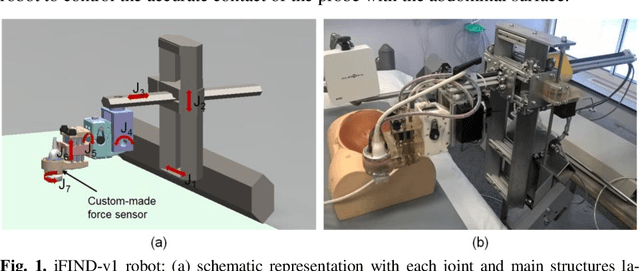Figure 1 for Robotic-assisted Ultrasound for Fetal Imaging: Evolution from Single-arm to Dual-arm System