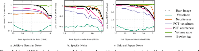 Figure 2 for The Multiscale Bowler-Hat Transform for Vessel Enhancement in 3D Biomedical Images