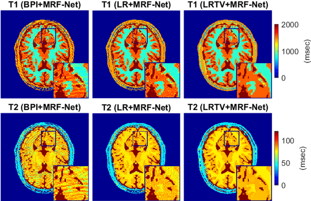 Figure 3 for Deep MR Fingerprinting with total-variation and low-rank subspace priors