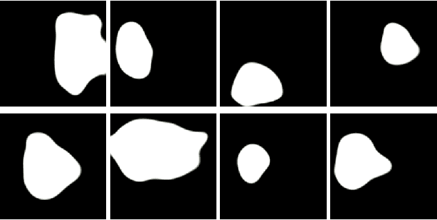 Figure 2 for PolypConnect: Image inpainting for generating realistic gastrointestinal tract images with polyps