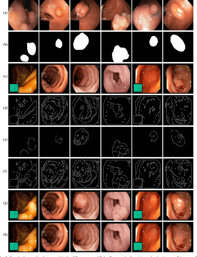 Figure 3 for PolypConnect: Image inpainting for generating realistic gastrointestinal tract images with polyps