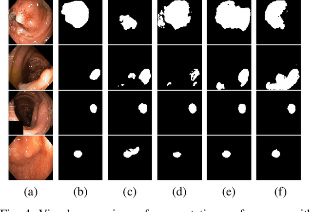 Figure 4 for PolypConnect: Image inpainting for generating realistic gastrointestinal tract images with polyps