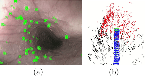 Figure 4 for ORBSLAM-based Endoscope Tracking and 3D Reconstruction