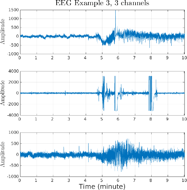 Figure 2 for Robust Unsupervised Transient Detection With Invariant Representation based on the Scattering Network
