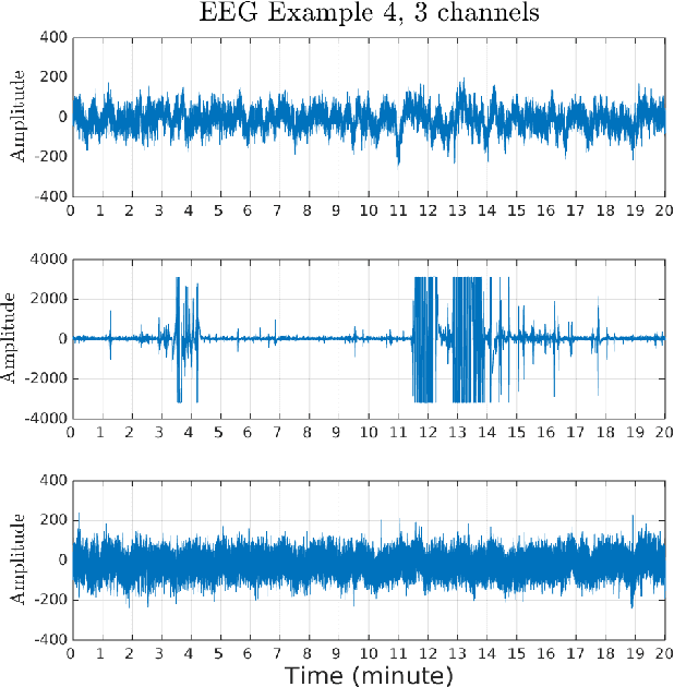 Figure 3 for Robust Unsupervised Transient Detection With Invariant Representation based on the Scattering Network