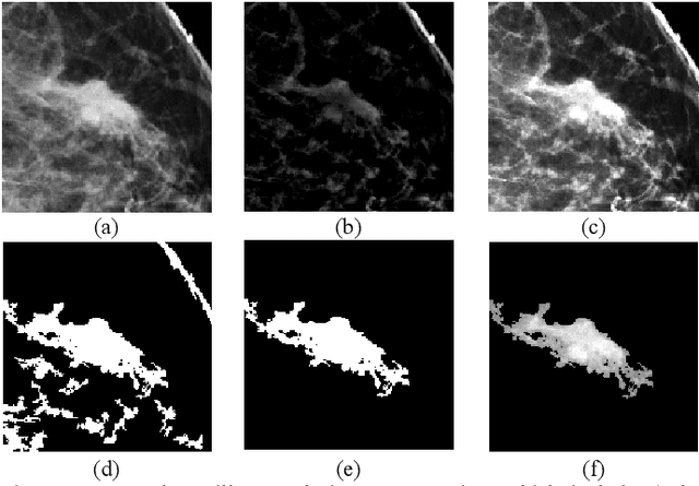 Figure 1 for Applying a random projection algorithm to optimize machine learning model for breast lesion classification