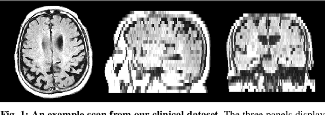 Figure 1 for Medical Image Imputation from Image Collections