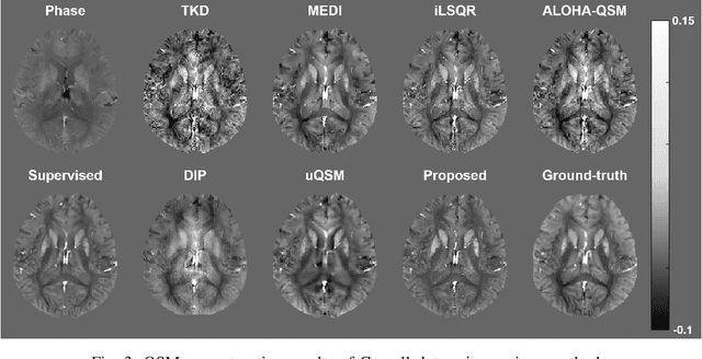 Figure 3 for CycleQSM: Unsupervised QSM Deep Learning using Physics-Informed CycleGAN