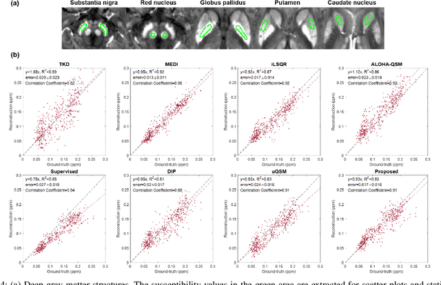 Figure 4 for CycleQSM: Unsupervised QSM Deep Learning using Physics-Informed CycleGAN