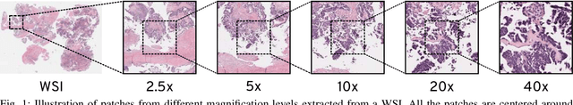 Figure 1 for Recognizing Magnification Levels in Microscopic Snapshots