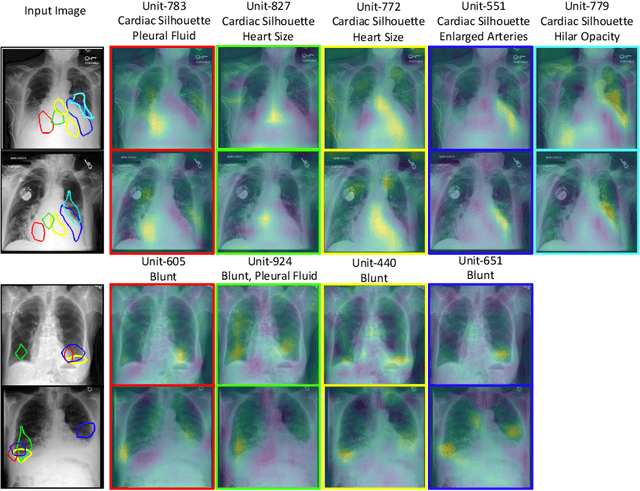Figure 4 for Using Causal Analysis for Conceptual Deep Learning Explanation