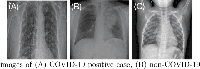 Figure 4 for A novel adversarial learning strategy for medical image classification