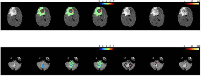 Figure 4 for Brain Tumor Segmentation using 3D-CNNs with Uncertainty Estimation