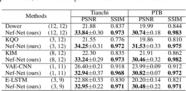 Figure 2 for Electrocardio Panorama: Synthesizing New ECG Views with Self-supervision