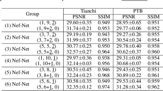 Figure 4 for Electrocardio Panorama: Synthesizing New ECG Views with Self-supervision