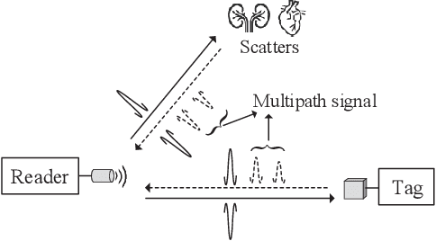 Figure 1 for Ultrasonic Backscatter Communication for Implantable Medical Devices