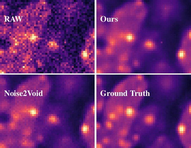Figure 1 for Fully Unsupervised Probabilistic Noise2Void