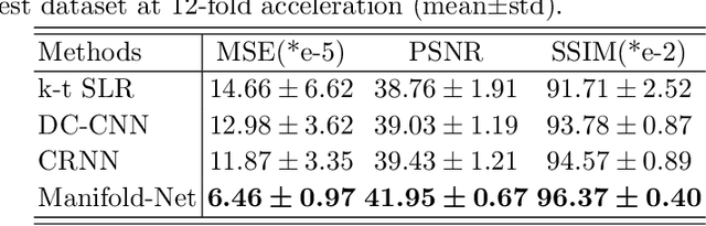 Figure 4 for Deep Manifold Learning for Dynamic MR Imaging