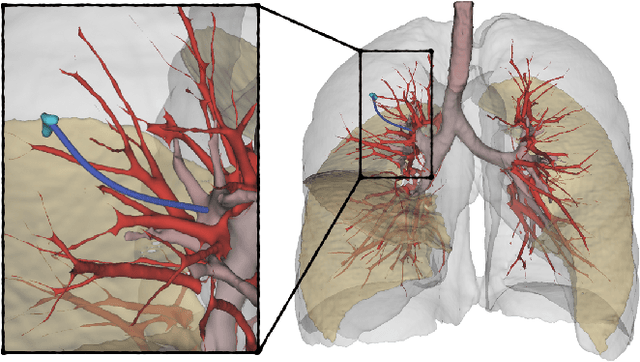 Figure 1 for A Clinical Dataset for the Evaluation of Motion Planners in Medical Applications
