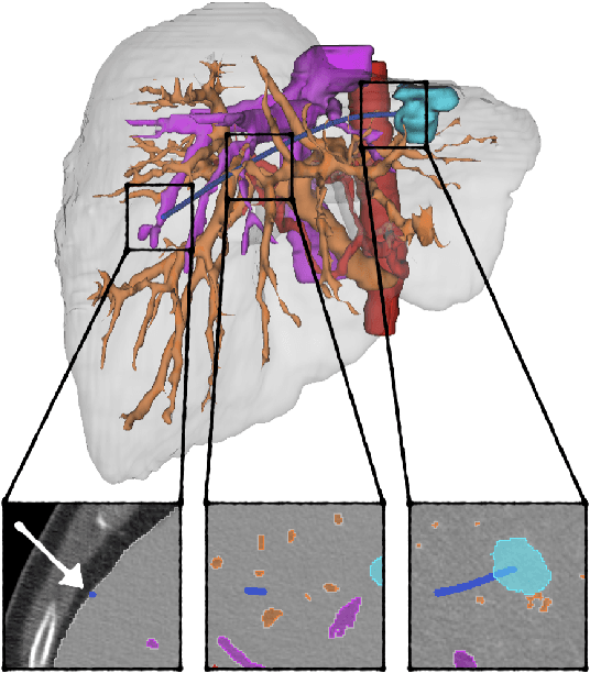 Figure 2 for A Clinical Dataset for the Evaluation of Motion Planners in Medical Applications