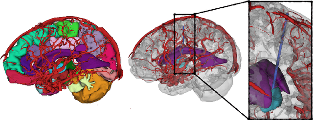 Figure 3 for A Clinical Dataset for the Evaluation of Motion Planners in Medical Applications