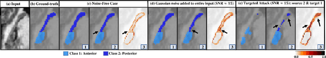 Figure 4 for Trustworthy Medical Segmentation with Uncertainty Estimation