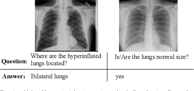 Figure 1 for MuVAM: A Multi-View Attention-based Model for Medical Visual Question Answering