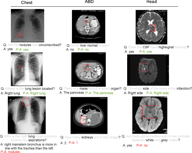 Figure 4 for MuVAM: A Multi-View Attention-based Model for Medical Visual Question Answering