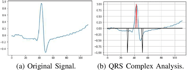 Figure 4 for Design of an Internet of Things System for Smart Hospitals