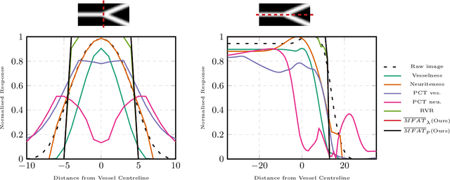 Figure 1 for 2D and 3D Vascular Structures Enhancement via Multiscale Fractional Anisotropy Tensor