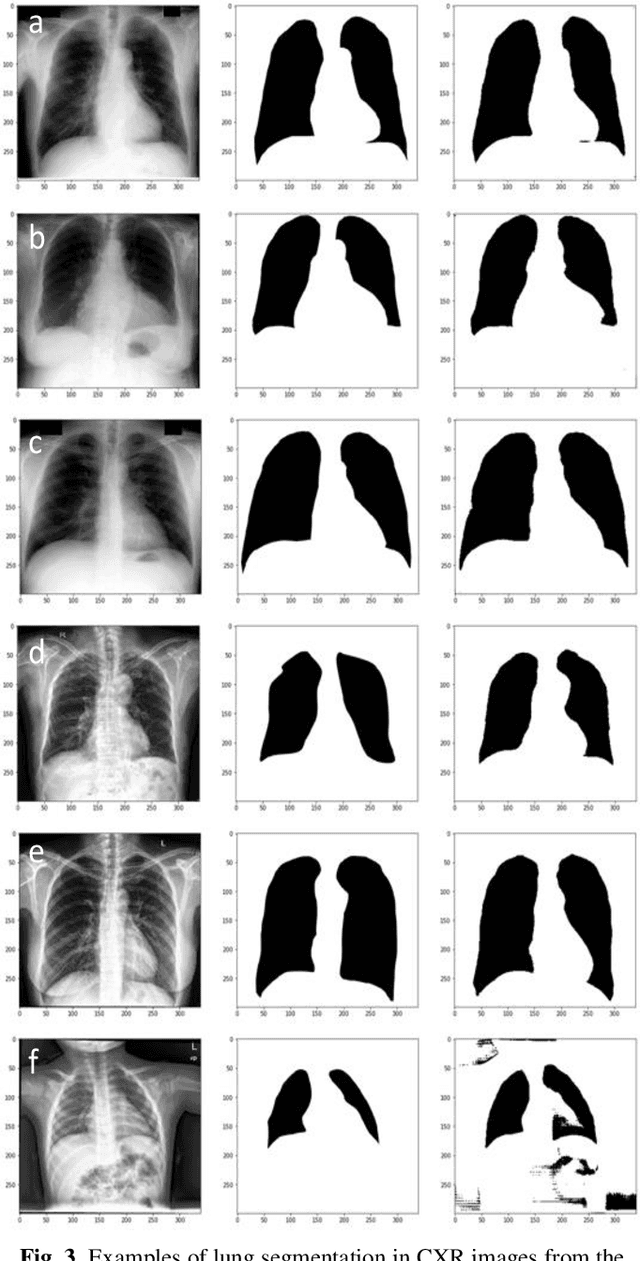 Figure 4 for Lung Segmentation in Chest X-rays with Res-CR-Net
