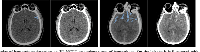 Figure 3 for Self-supervised Learning from 100 Million Medical Images