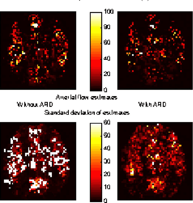 Figure 4 for Stochastic Variational Bayesian Inference for a Nonlinear Forward Model