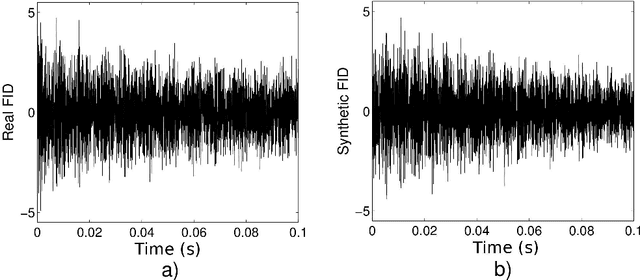 Figure 3 for Bayesian Inference for NMR Spectroscopy with Applications to Chemical Quantification