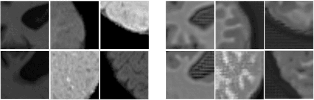 Figure 1 for Adversarial normalization for multi domain image segmentation