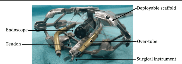 Figure 1 for A cable-driven parallel manipulator with force sensing capabilities for high-accuracy tissue endomicroscopy