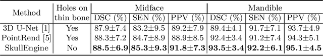 Figure 4 for SkullEngine: A Multi-stage CNN Framework for Collaborative CBCT Image Segmentation and Landmark Detection