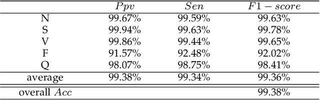 Figure 4 for Two-stream Network for ECG Signal Classification