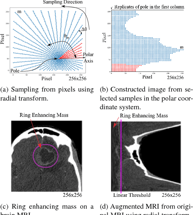 Figure 1 for Image Augmentation using Radial Transform for Training Deep Neural Networks