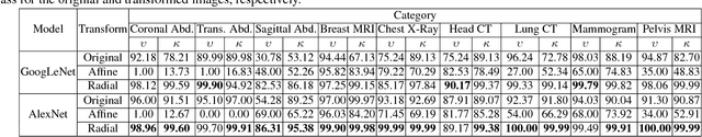 Figure 4 for Image Augmentation using Radial Transform for Training Deep Neural Networks