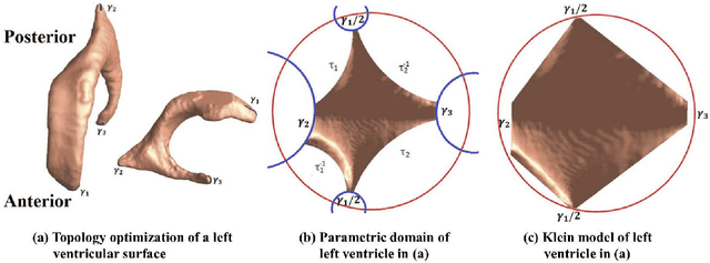 Figure 4 for Predicting Future Cognitive Decline with Hyperbolic Stochastic Coding