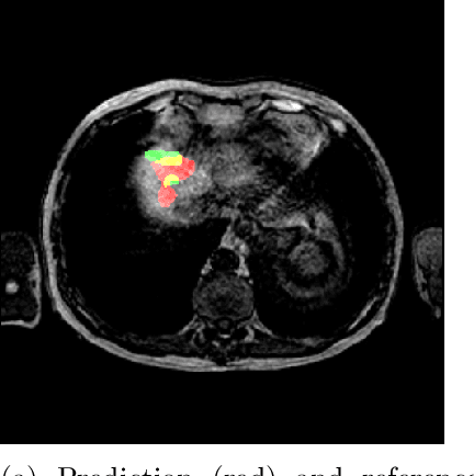Figure 3 for Influence of uncertainty estimation techniques on false-positive reduction in liver lesion detection
