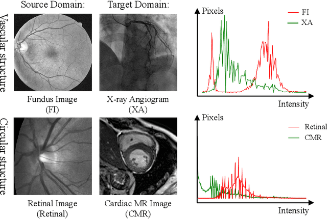 Figure 1 for Contrastive Semi-supervised Learning for Domain Adaptive Segmentation Across Similar Anatomical Structures