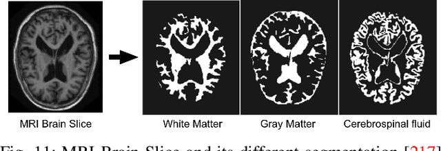 Figure 3 for A Review of Deep Learning with Special Emphasis on Architectures, Applications and Recent Trends
