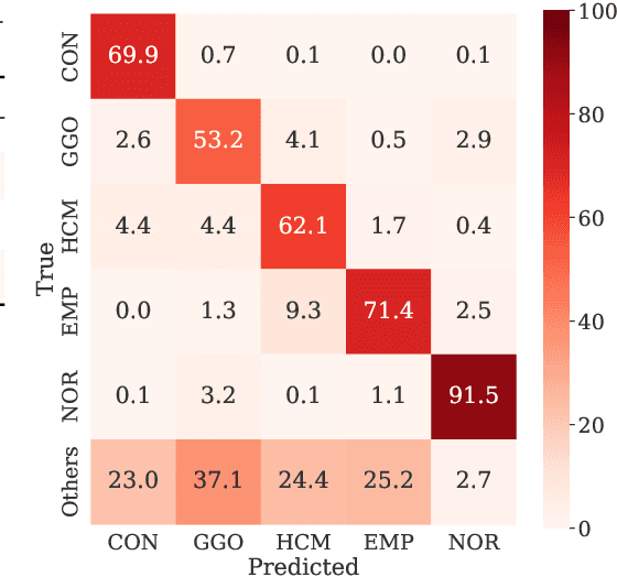 Figure 3 for Weak Supervision in Convolutional Neural Network for Semantic Segmentation of Diffuse Lung Diseases Using Partially Annotated Dataset