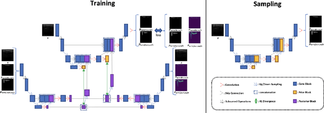 Figure 3 for Weakly- and Semi-Supervised Probabilistic Segmentation and Quantification of Ultrasound Needle-Reverberation Artifacts to Allow Better AI Understanding of Tissue Beneath Needles