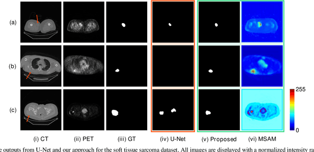Figure 3 for Multimodal Spatial Attention Module for Targeting Multimodal PET-CT Lung Tumor Segmentation