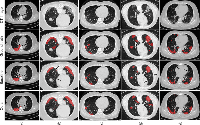 Figure 3 for Exploiting Shared Knowledge from Non-COVID Lesions for Annotation-Efficient COVID-19 CT Lung Infection Segmentation